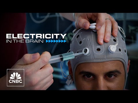 Inside Neuroelectrics, the brain science start-up hoping to curb epilepsy and depression